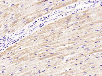 TNNI3 Rabbit Polyclonal Antibody