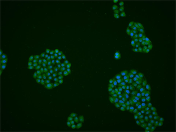 TET3 Rabbit Polyclonal Antibody