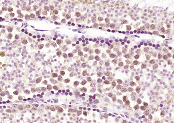 TET3 Rabbit Polyclonal Antibody