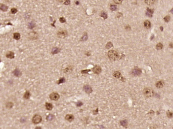 TNRC18 Rabbit Polyclonal Antibody