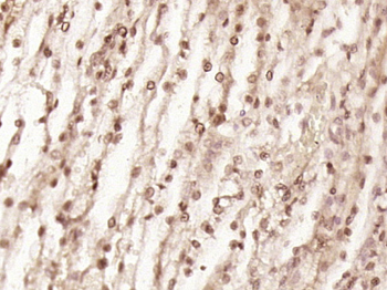 TNRC18 Rabbit Polyclonal Antibody
