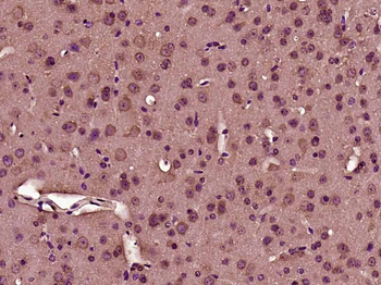 Phospho-TOB (Ser164) Rabbit Polyclonal Antibody