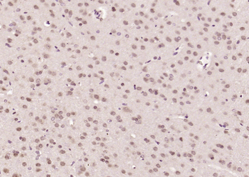 WTX Rabbit Polyclonal Antibody