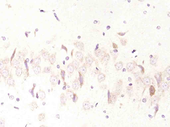 WASF3 Rabbit Polyclonal Antibody