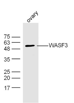 WASF3 Rabbit Polyclonal Antibody
