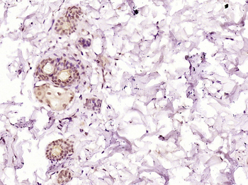 ZZZ3 Rabbit Polyclonal Antibody