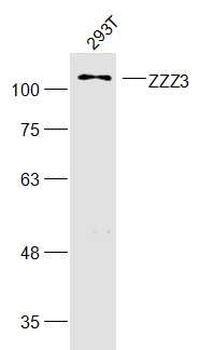 ZZZ3 Rabbit Polyclonal Antibody