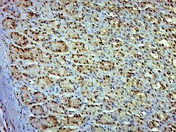 ZSWIM4 Rabbit Polyclonal Antibody