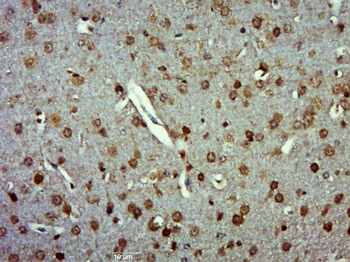 ZSWIM6 Rabbit Polyclonal Antibody