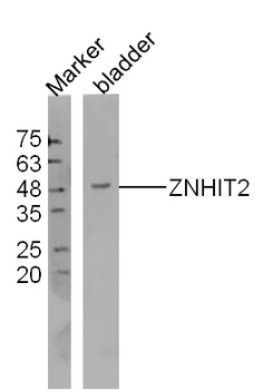 ZNHIT2 Rabbit Polyclonal Antibody