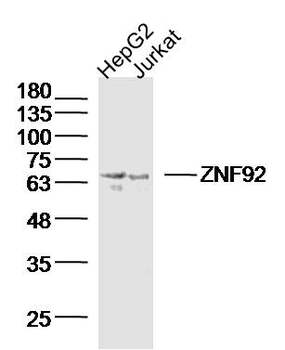 ZNF92 Rabbit Polyclonal Antibody