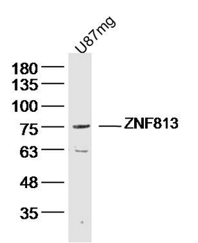ZNF813 Rabbit Polyclonal Antibody