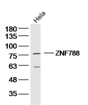ZNF788 Rabbit Polyclonal Antibody