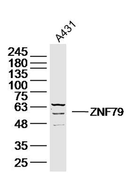 ZNF79 Rabbit Polyclonal Antibody