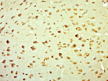 ZNF782 Rabbit Polyclonal Antibody