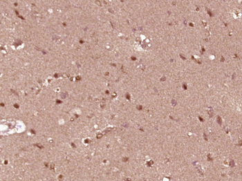 ZNF777 Rabbit Polyclonal Antibody