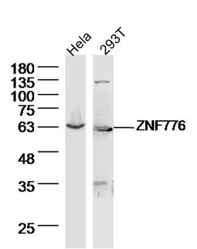 ZNF776 Rabbit Polyclonal Antibody