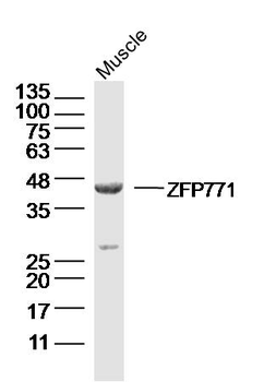 ZFP771 Rabbit Polyclonal Antibody
