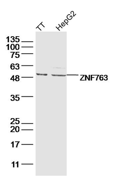 ZNF763 Rabbit Polyclonal Antibody