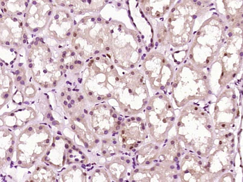 ZNF687 Rabbit Polyclonal Antibody