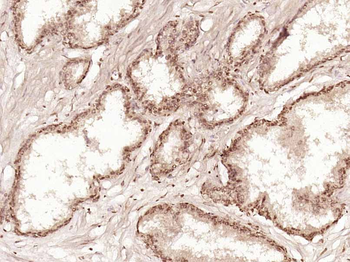 ZNF676 Rabbit Polyclonal Antibody