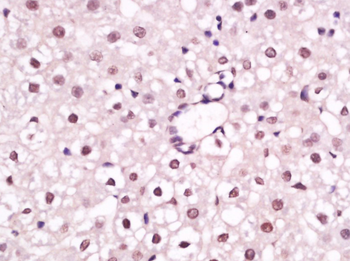 Phospho-HNF4 (Ser304) Rabbit Polyclonal Antibody