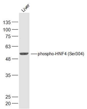 Phospho-HNF4 (Ser304) Rabbit Polyclonal Antibody