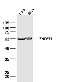 ZNF671 Rabbit Polyclonal Antibody