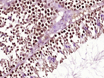 ZBTB9/ZNF919 Rabbit Polyclonal Antibody