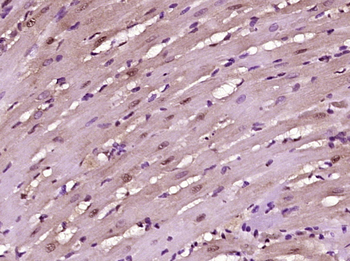 ZBTB9/ZNF919 Rabbit Polyclonal Antibody