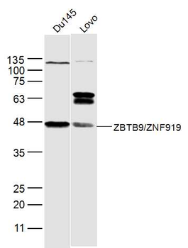 ZBTB9/ZNF919 Rabbit Polyclonal Antibody