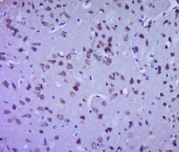 ZC3H12C Rabbit Polyclonal Antibody