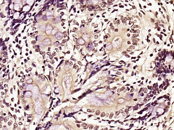 ZC3H13 Rabbit Polyclonal Antibody