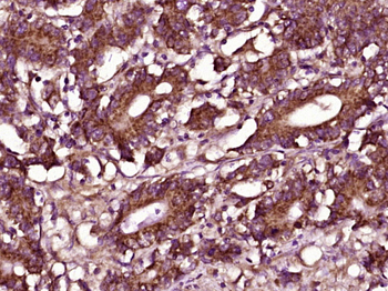 ZDHHC13/HIP14L Rabbit Polyclonal Antibody