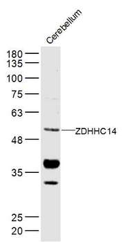 ZDHHC14 Rabbit Polyclonal Antibody