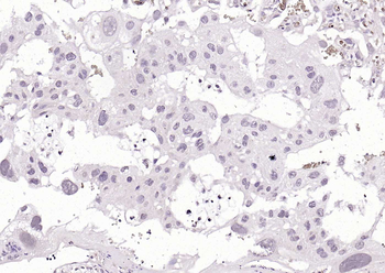 ZDHHC6 Rabbit Polyclonal Antibody