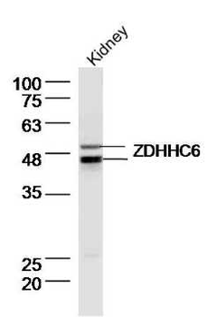 ZDHHC6 Rabbit Polyclonal Antibody