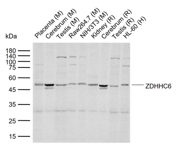 ZDHHC6 Rabbit Polyclonal Antibody