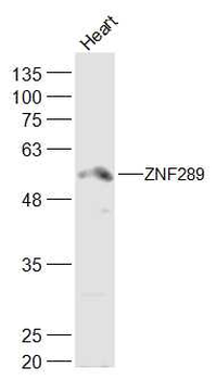 ARFGAP2 Rabbit Polyclonal Antibody