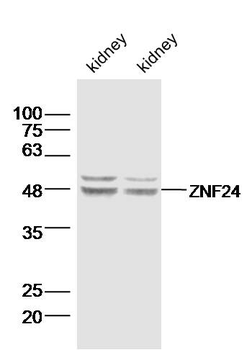 ZNF24 Rabbit Polyclonal Antibody