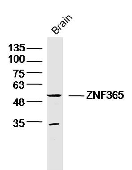 ZNF365 Rabbit Polyclonal Antibody