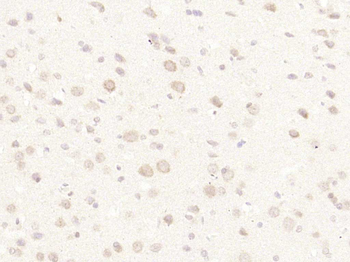 ZNF622 Rabbit Polyclonal Antibody