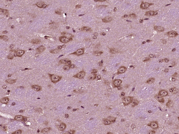 ZFAND2B Rabbit Polyclonal Antibody