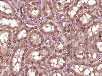 ZFAND2B Rabbit Polyclonal Antibody