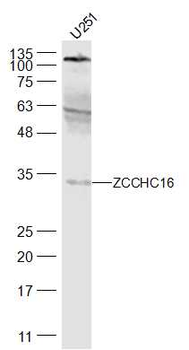 ZCCHC16 Rabbit Polyclonal Antibody