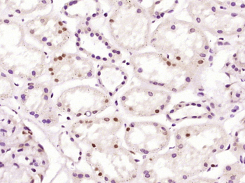 ZCCHC4 Rabbit Polyclonal Antibody