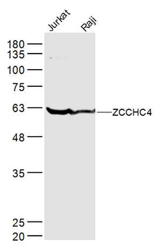 ZCCHC4 Rabbit Polyclonal Antibody