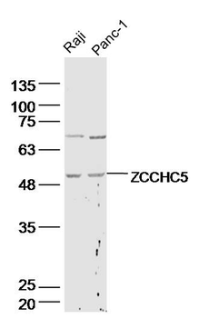 ZCCHC5 Rabbit Polyclonal Antibody