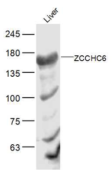 ZCCHC6 Rabbit Polyclonal Antibody