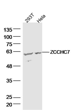 ZCCHC7 Rabbit Polyclonal Antibody